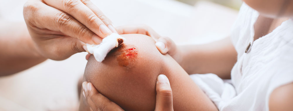 Wound care treatment